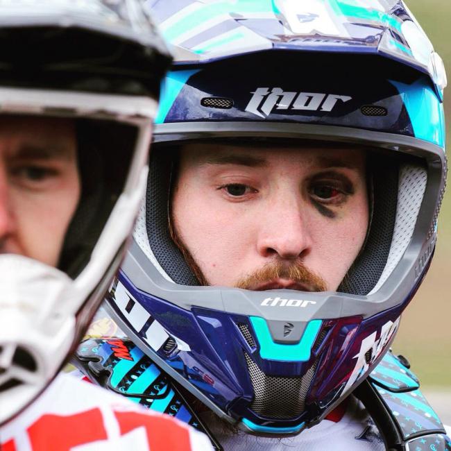 Cody's eye is still showing the effects from his crash in Texas.